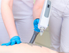 M&aacute;quina profesional de eliminaci&oacute;n de tatuajes con l&aacute;ser Yag a la venta
